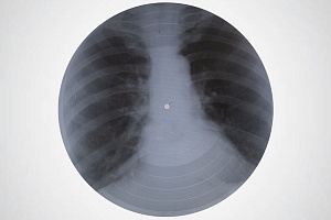 Пластинка на рентгеновском снимке. Подпольная запись, самиздат